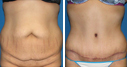 Before & After Photos